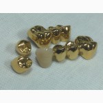 Установки покрытия зубных протезов под золото из Беларуси