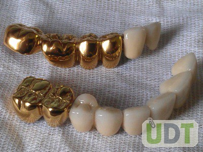 Фото 6. Установки покрытия зубных протезов под золото из Беларуси