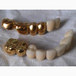 Установки покрытия зубных протезов под золото из Беларуси